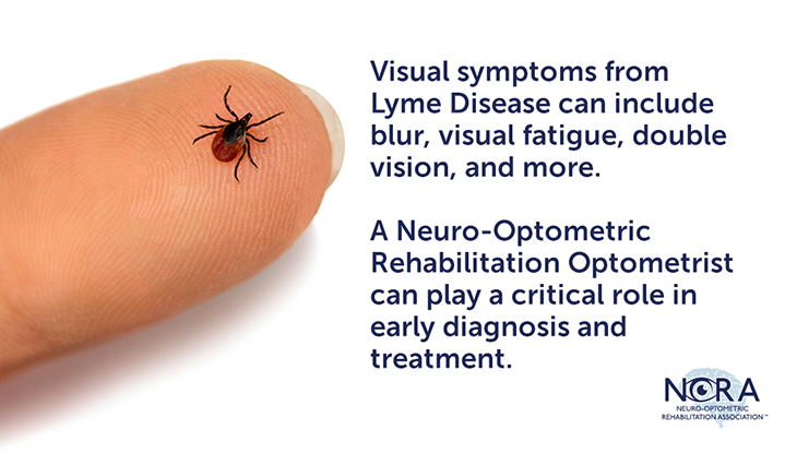 link to /patients-caregivers/about-brain-injuries-vision/lyme-disease-and-vision